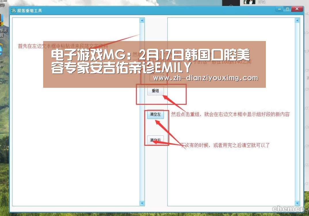 电子游戏MG:2月17日韩国口腔美容专家安吉佑亲诊EMILY(图1) 电子游戏MG