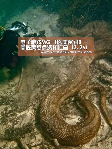 电子游戏MG
